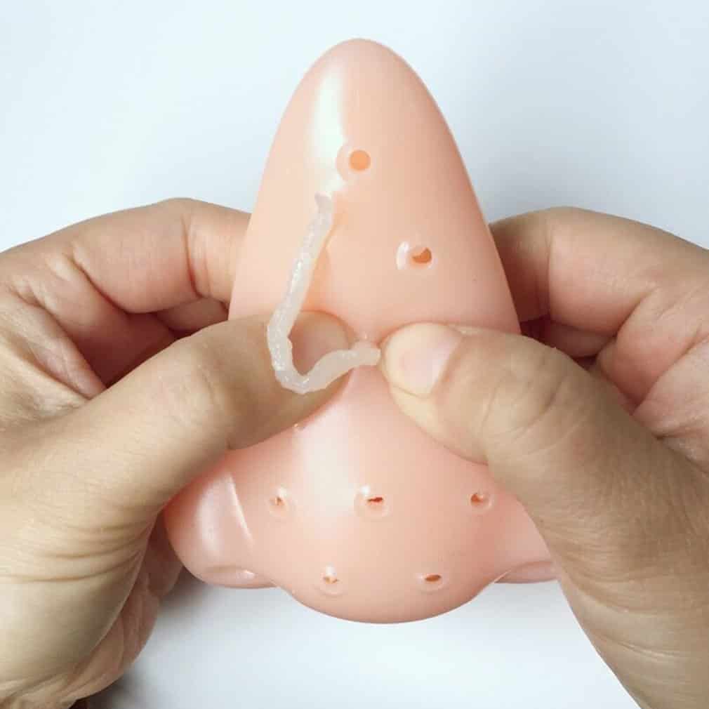 Anti-Stress Spielzeug Mitesser